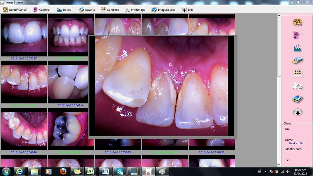 Intraoral Camera W9945